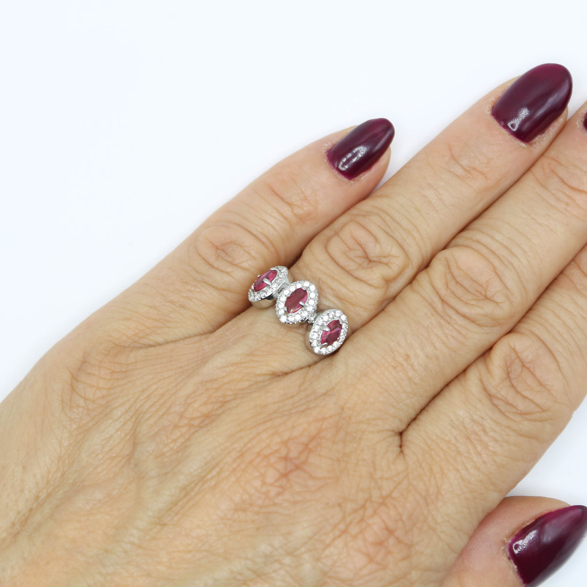 Anello Tris